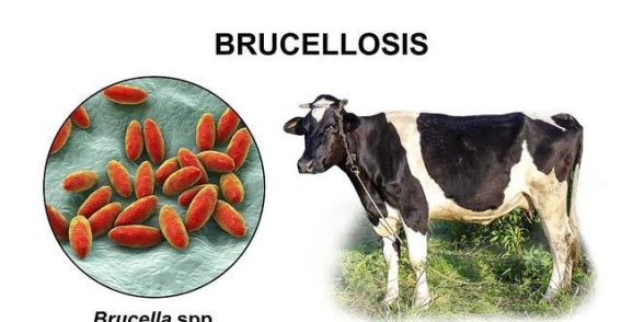冬季食补小心布鲁菌病！女性反复发热竟因牛羊肉感染