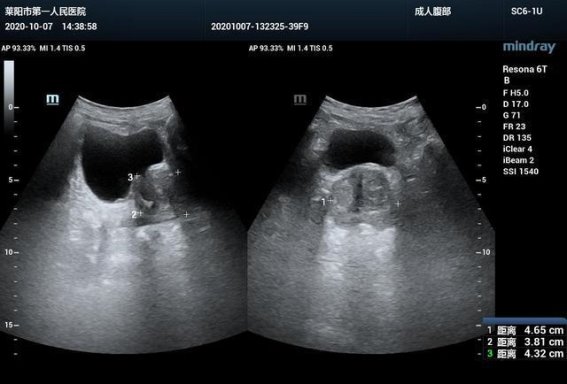 为什么男生随着年龄增大，会尿不高也尿不远了？原因在这