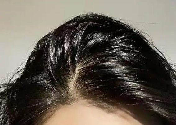 湿气最怕这货！夏天吃了它，身体从头暖到脚，湿寒全赶跑