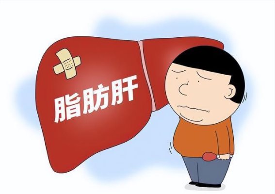 脂肪肝患者饮食警惕：这5种食物加重肝脏负担，需远离