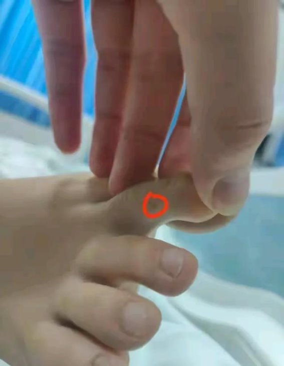 三亚女生被蛇咬死完整时间线：黄金救援时间被他们自己亲手耗尽