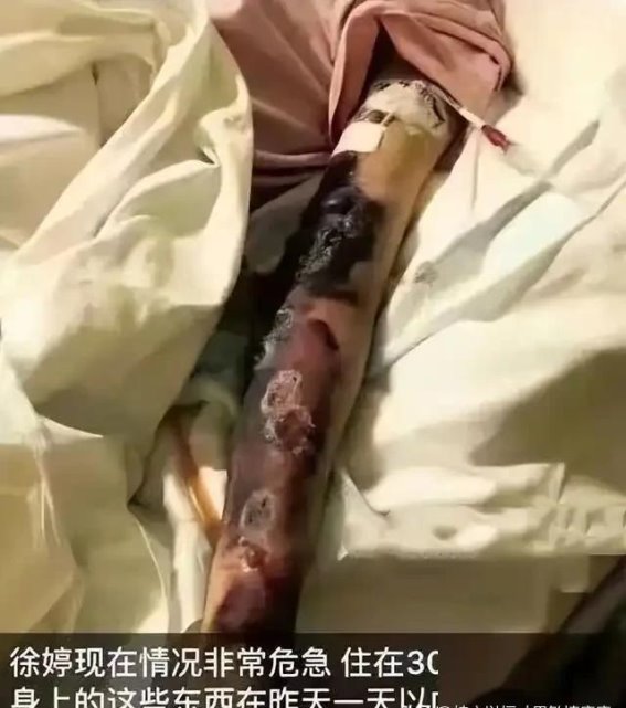 重男轻女观念下的命运：徐婷的故事与人生反思