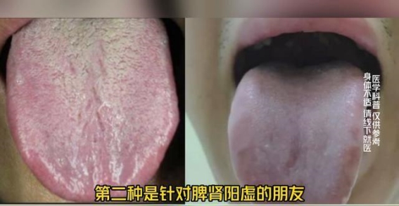 桂附地黄丸搭配使用，助力阴阳双补效果翻倍