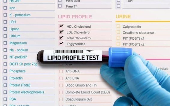 冬季降血脂的关键时段：清华大学研究揭示的两个黄金时间