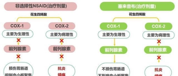 骨关节炎患者如何科学用药：布洛芬与西乐葆的选择与应用