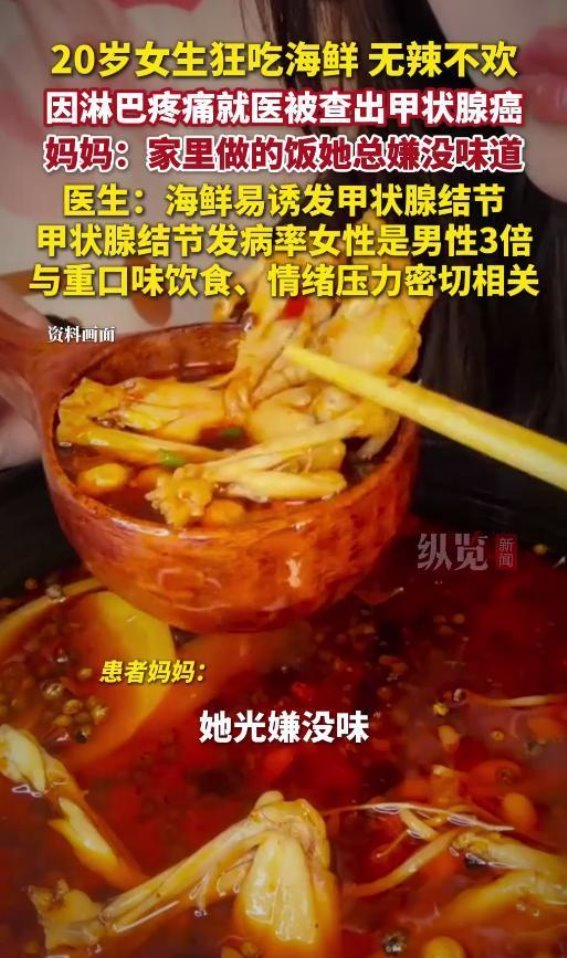 20岁女生因频繁吃海鲜查出甲状腺癌，背后隐藏的健康隐患