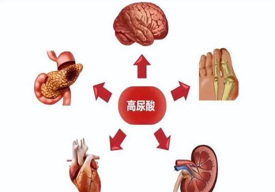 酱油与鸡精对尿酸水平的真实影响：科学解读与健康建议