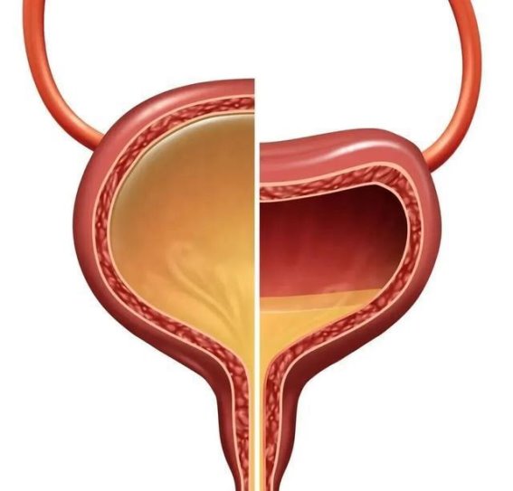 为什么憋尿能行千里，拉稀却寸步难行？