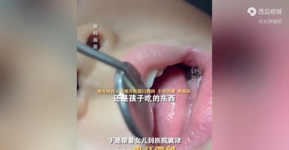 细碎食物与儿童牙齿发育：家长的过度担忧与隐秘危害