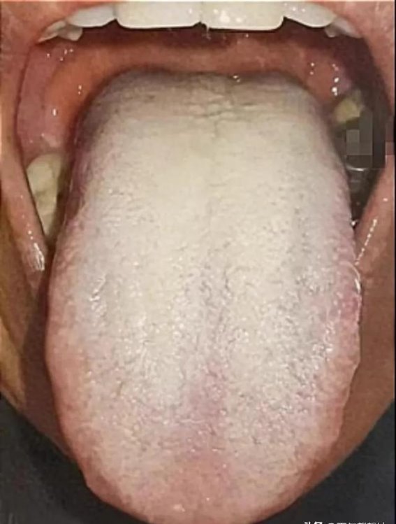 夏季食欲不振，舌苔厚腻？试试这些穴位调理，轻松清理湿气恢复胃口