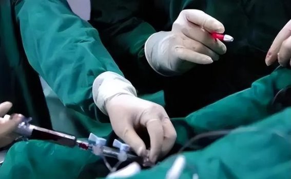 心脏支架手术后的警示：为何复发依旧不可避免？