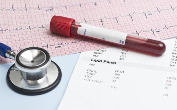 降甘油三酯不难，四个数字口诀助你稳住健康