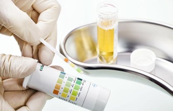 肾脏健康的误区：从过量饮水到肾衰竭的隐患