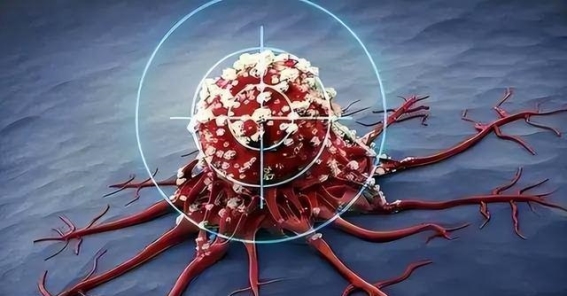 从化疗到死亡，仅仅半年，这四种癌症患者不能盲目化疗！