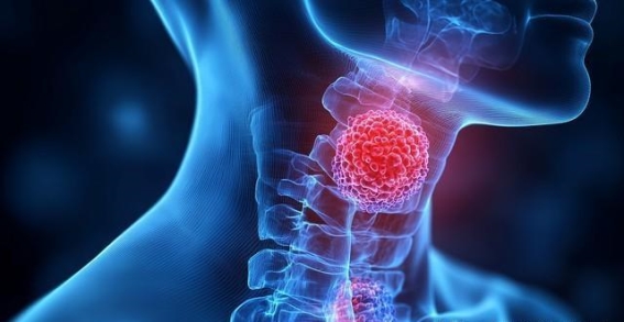 腌制食品与食道癌的隐秘关系：健康的“隐形杀手”