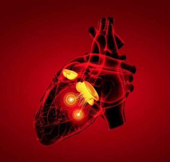 动脉硬化的年轻化：睡得多，血管更脆弱？