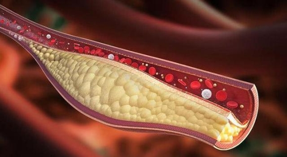 核桃的力量：脑梗患者的辅助修复之路