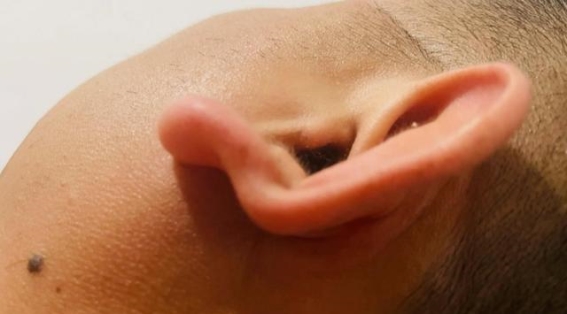 耳朵发出的心脏警告信号，你注意到了吗？