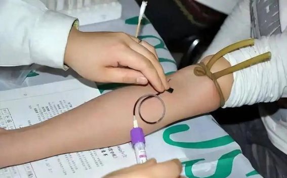 猕猴桃与高血脂：每天一颗，血脂管理更轻松