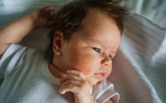 皮肤瘙痒、变厚，像长癣一样是怎么回事？