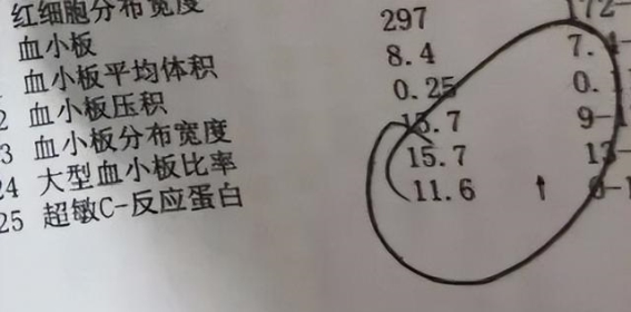 适度抗炎，延续长寿的秘密