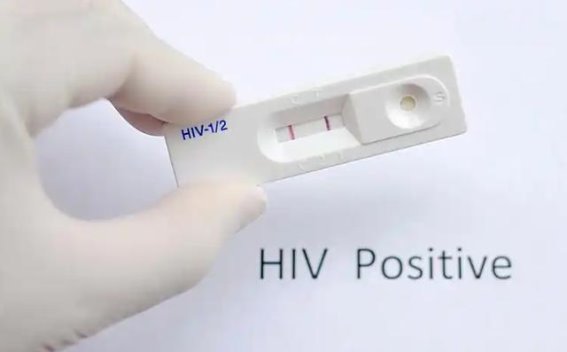 中老年人群体中的艾滋病风险：隐秘的威胁与有效的预防