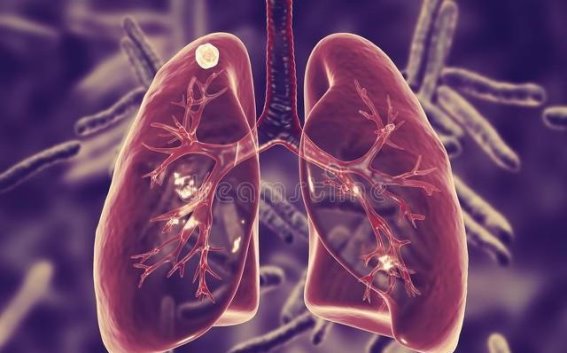 体内结节患者注意！这三种食物应尽量避免，助力结节散去